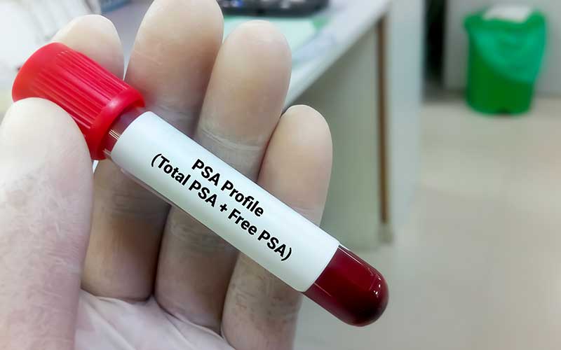 psa libero e totale esami sangue